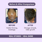 Hair growth gummies before after results - Healthetc