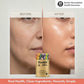 Skin Health Gummy before and after comparison showing improved skin hydration and healthy-looking skin - Healthetc