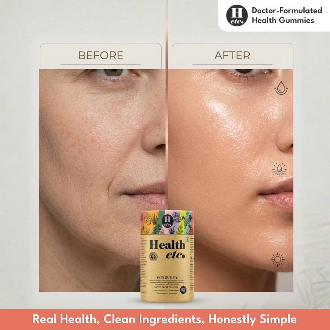 Skin Health Gummy before and after comparison showing improved skin hydration and healthy-looking skin - Healthetc